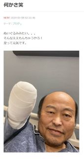 ◆佐野慈紀さんが公開した右腕切断後の様子【写真】