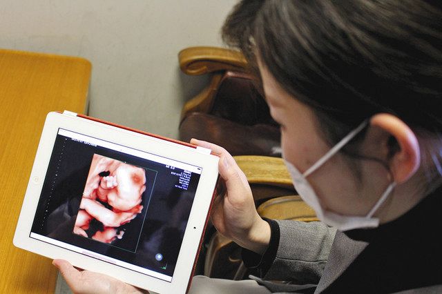 自宅でもおなかの赤ちゃん鮮明 浜松医療センターが配信サービス 中日新聞しずおかweb