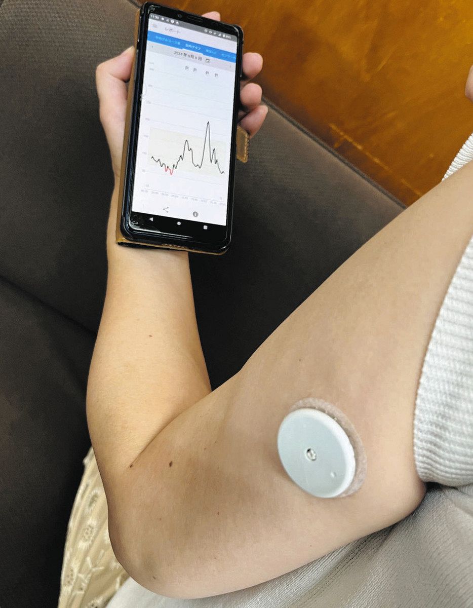 血糖値の変動 スマホで見える化 CGM、糖尿病の改善に効果あり