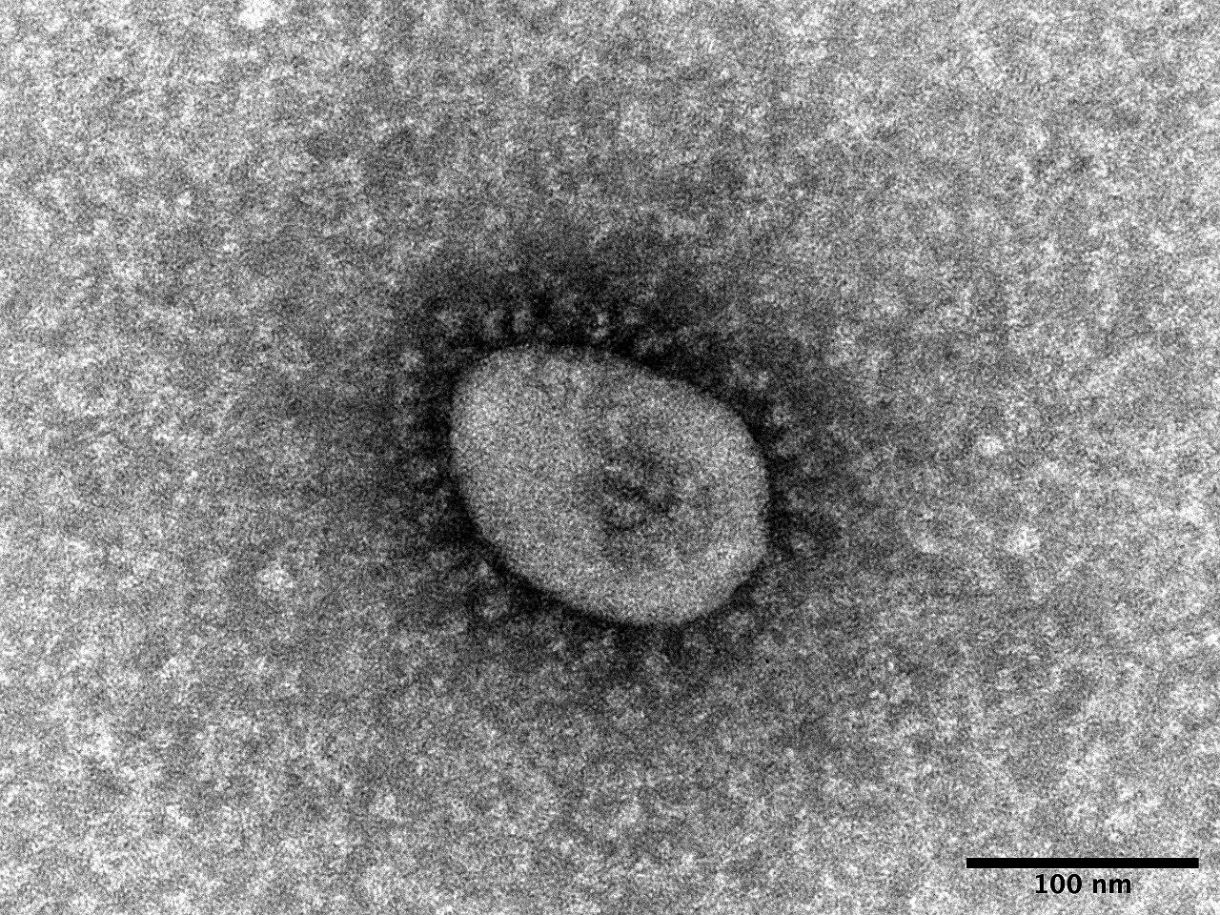 オミクロン株 Xe 系統の国内初確認に倉持仁院長が悲鳴 昨日発熱外来の陽性率50 とも 中日スポーツ 東京中日スポーツ