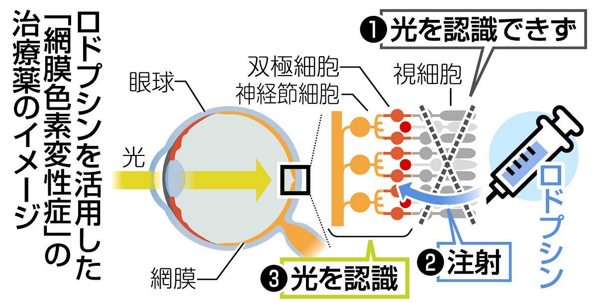 網膜色素変性症」治療薬開発に名古屋工大研究のタンパク質が貢献 患者