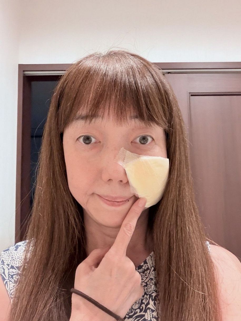 実際の投稿】太田光代社長、「美人が台無し」痛々しいガーゼ姿：中日