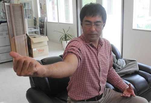 大野さんは腕が真っすぐに伸びなくなった＝２０１５年１月、沖縄県那覇市で（平野梓撮影）