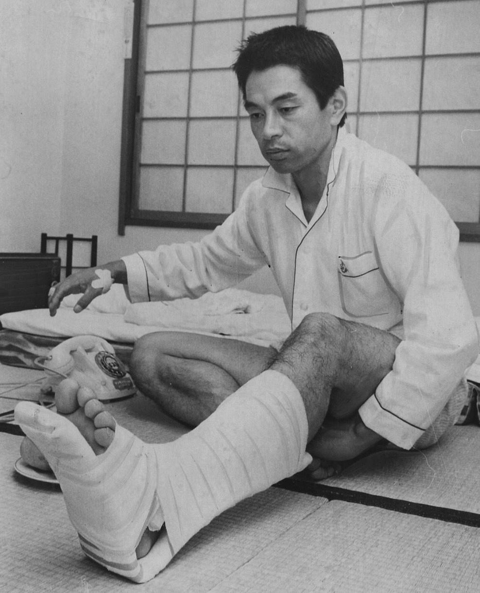 骨折した左足に巻かれた包帯が痛々しい高木守道