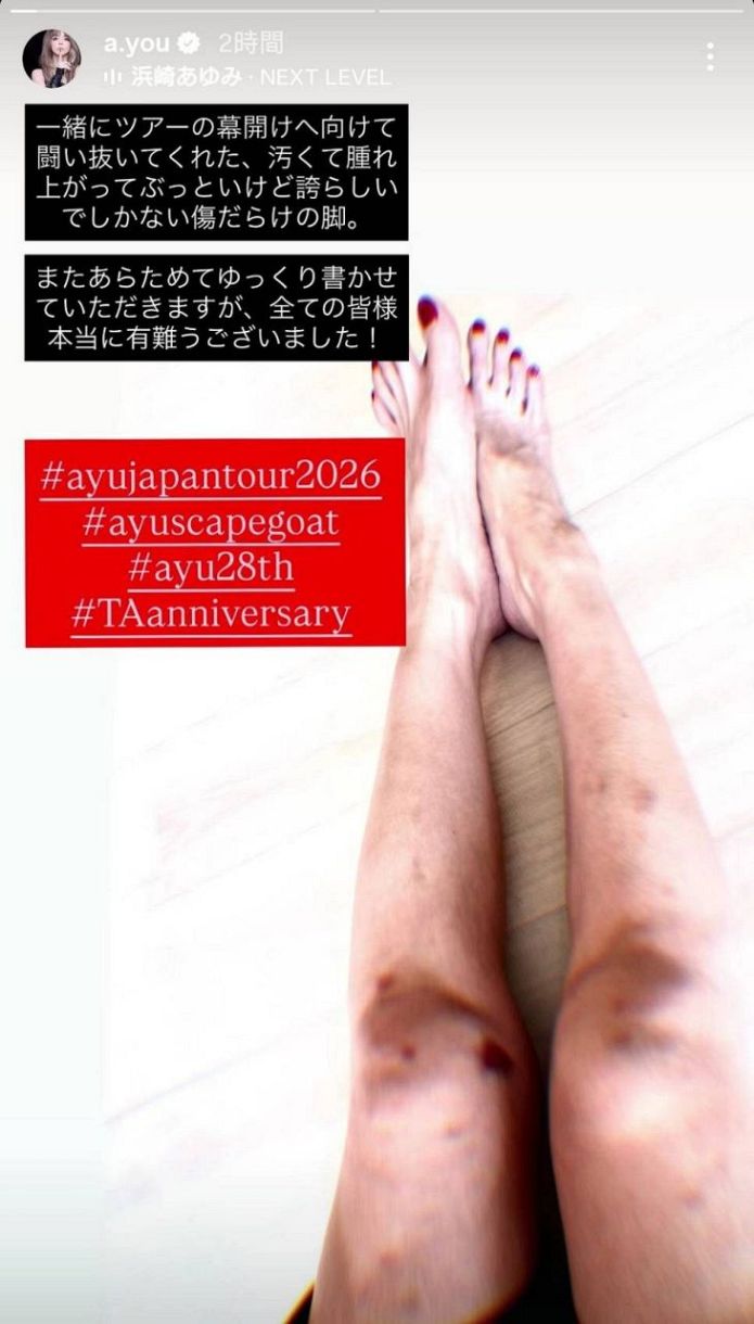 写真】浜崎あゆみ、誇らしい傷だらけの脚「痛々しい傷は勲章」：中日