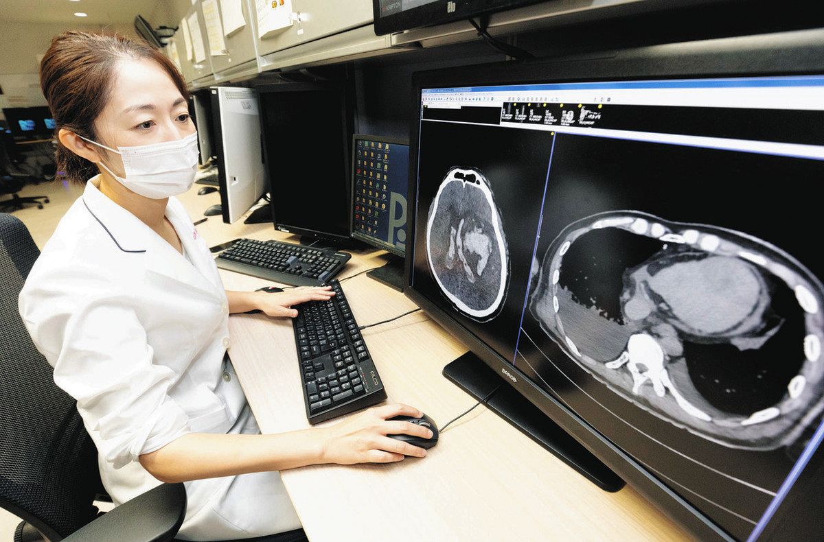 死亡時画像診断」虐待の痕跡も見逃さず 導入の三重大病院、Aiの可能性