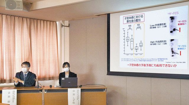 画像で子宮体がん進行予測 福井大が研究成果発表 中日新聞web