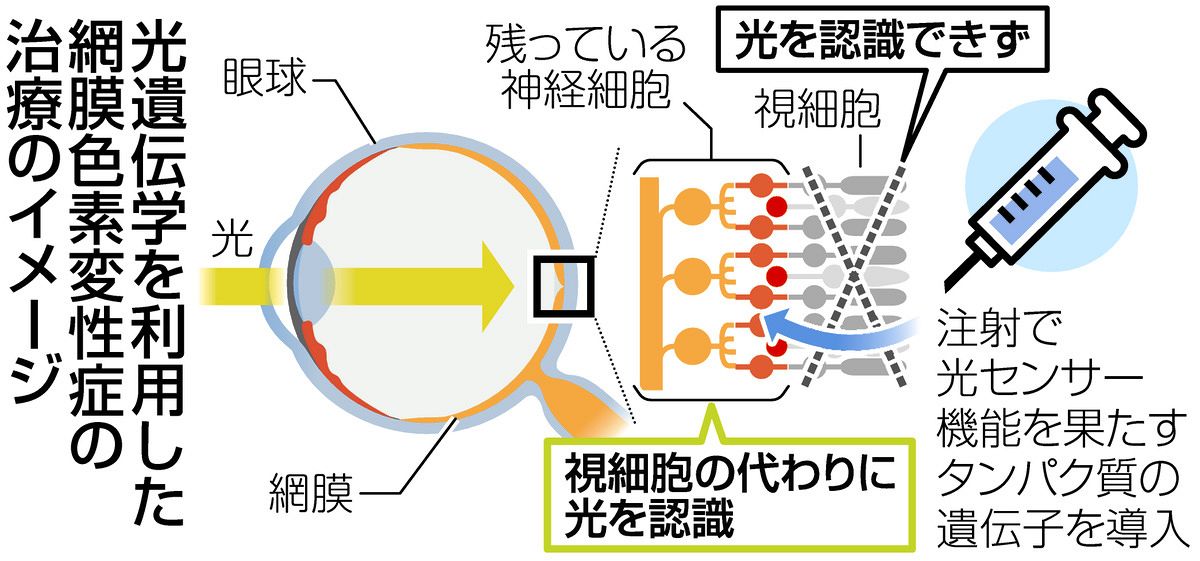 目の難病「網膜色素変性症」視覚再生へ 光遺伝学の技術活用、名工大