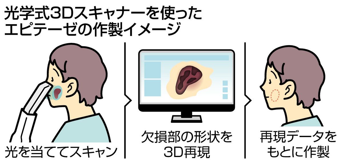 鼻や耳…顔の一部を再現する画期的手法 岐阜大病院教授が開発、3Dスキャナー使い：中日新聞Web