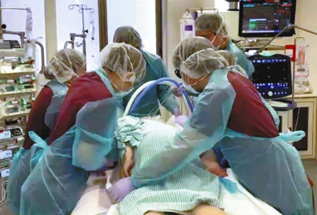 うつぶせ寝で血中酸素改善 腹臥位療法 新型コロナ患者に効果 ：中日新聞Web