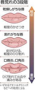 唇ケア 症状に合わせて 中日新聞web