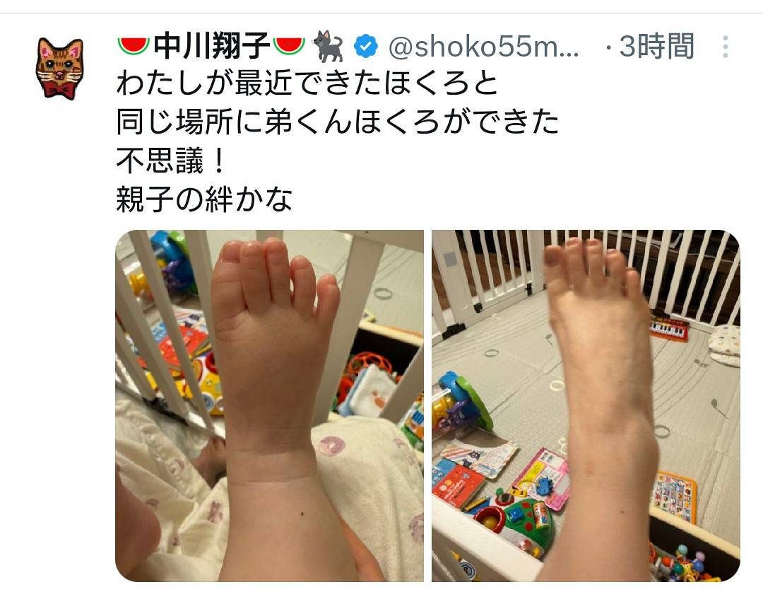 実際の投稿】中川翔子、「紋章だな」とファン反応、双子の弟くんと同じ