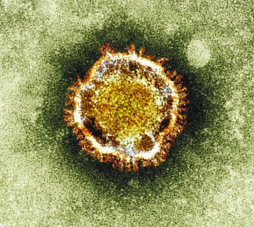 英国健康保護庁が発表したコロナウイルスの電子顕微鏡写真（AP）