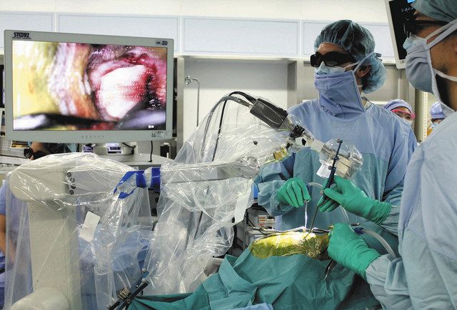 脳腫瘍の内視鏡手術 「外視鏡」も使い負担軽減：中日新聞Web