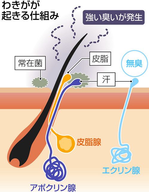 わきの臭いが気になる・・・。もしかしたら「わきが」？ 増える治療の選択肢：中日新聞Web