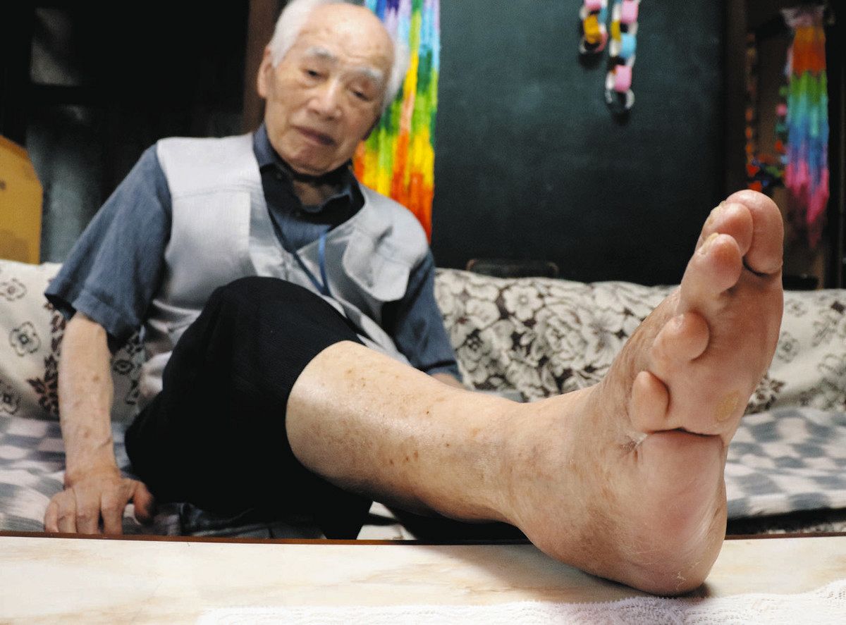 戦争 の 傷跡