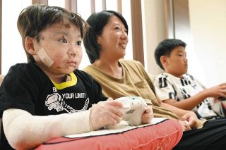 ＜みえ人模様＞　難病「表皮水疱症」と闘う田邉柊さん