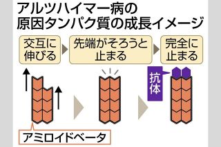 「アルツハイマー病」原因タンパク質の成長過程を解明　生命創成探究センターや名市大など、治療法につながる可能性